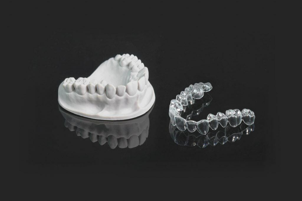 3d printed dental molds