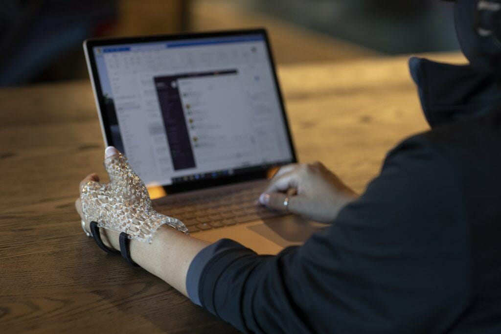 3 d印制wrist guard