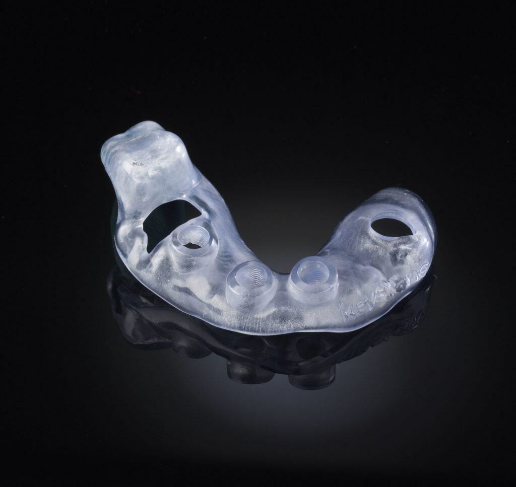 keystone 3d printing