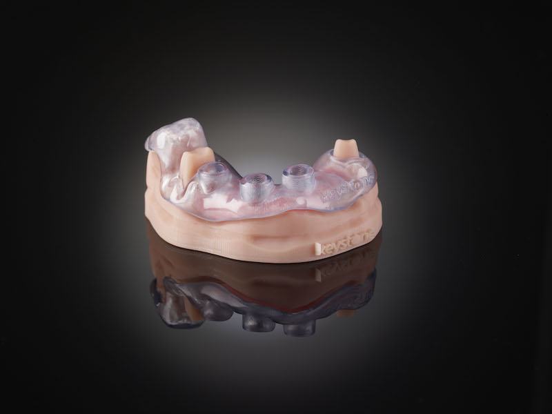 KeyGuide Teeth Mold