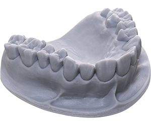 Implant Models