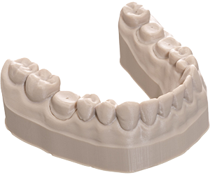 Removable Die Models